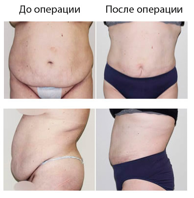 Результат операции