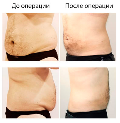 Результат операции