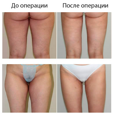 Результат операции