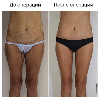 Результат операции